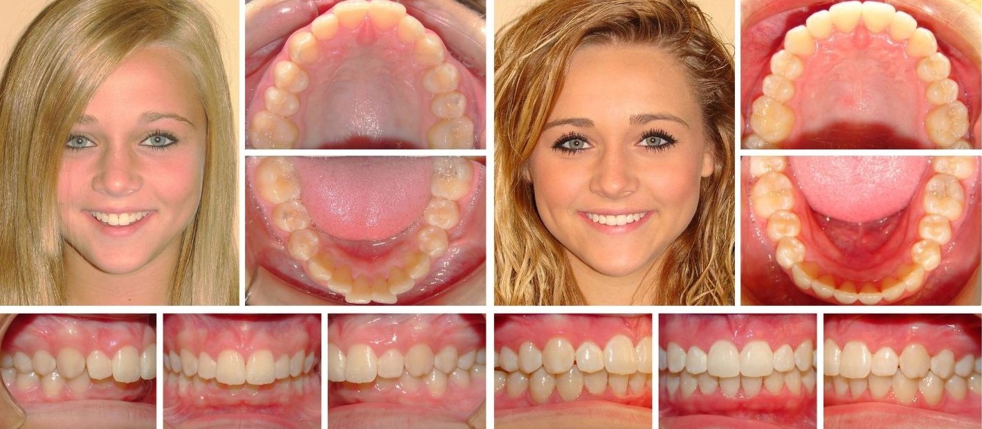 Smile gallery case 2